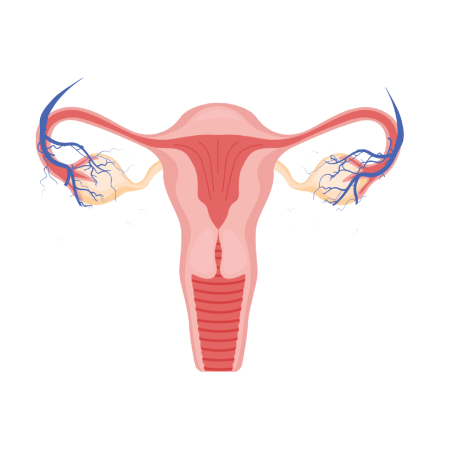 Pelvic Congestive Syndrome